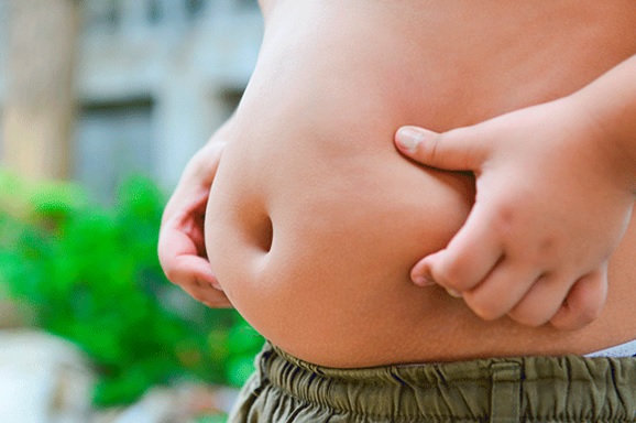 Niño Obeso obesidad infantil