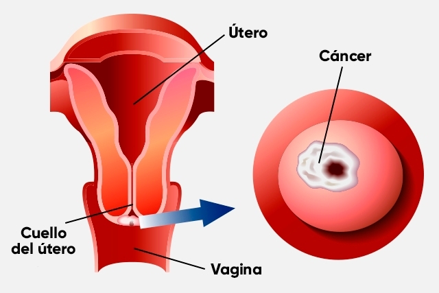 utero