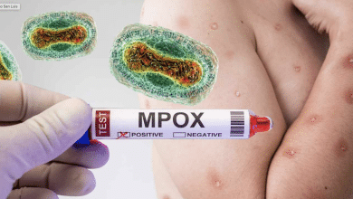 virus mpox