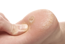 ojos de pescado salud vida sana