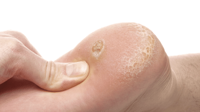 ojos de pescado salud vida sana