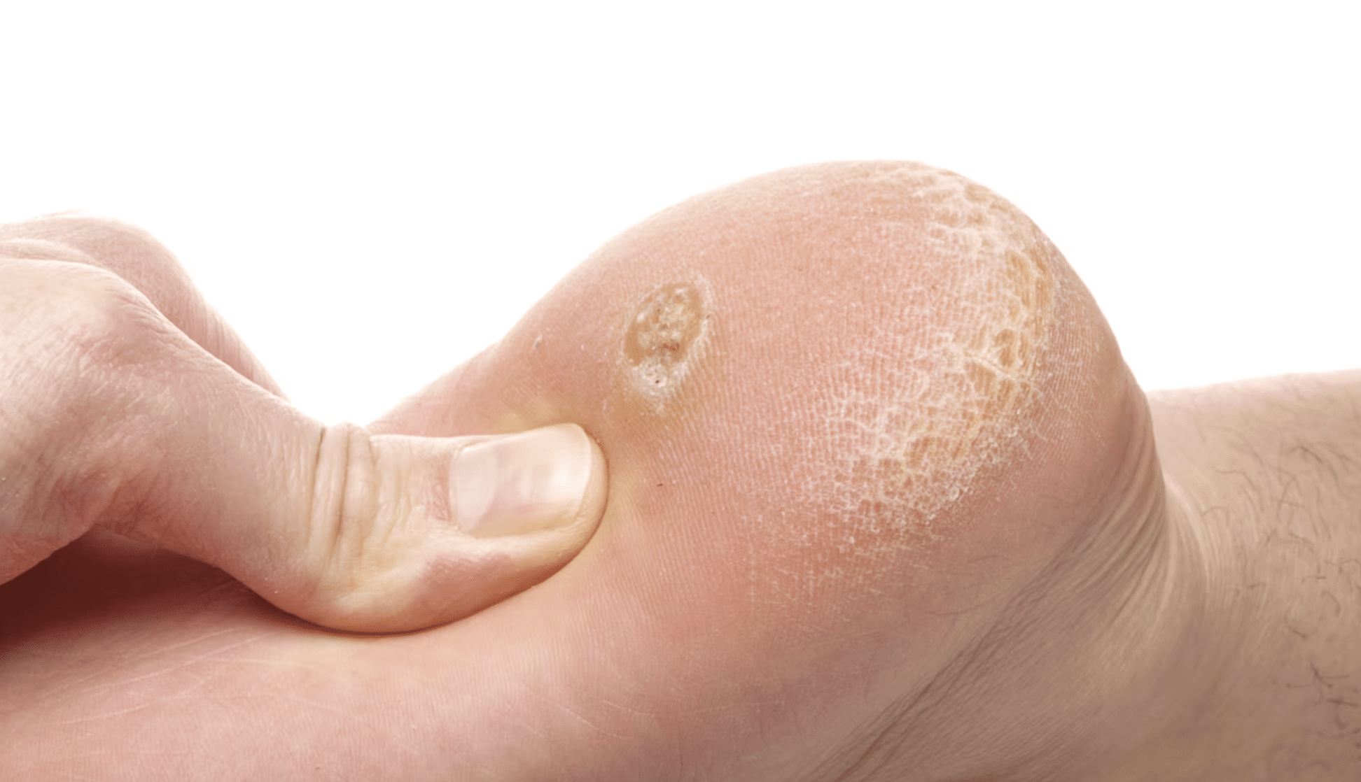 ojos de pescado salud vida sana