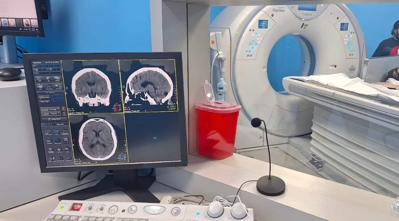 imss alzheimer