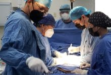 imss donación órganos slp